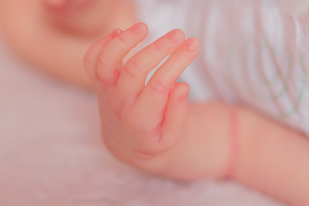 乳児てんかん性スパズム症候群